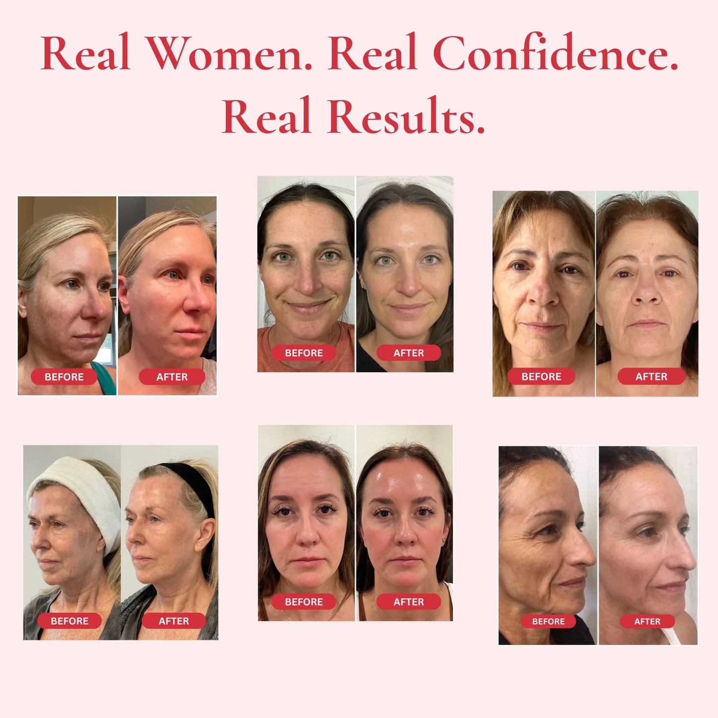 AETERNA™ l Madeca Anti Aging Creme