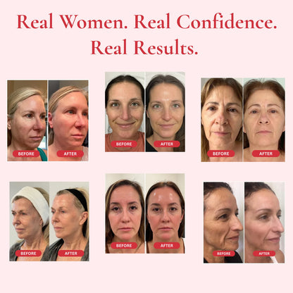 AETERNA™ l Madeca Anti Aging Creme